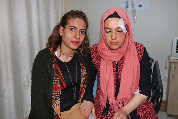 AK Parti'li kadınlara taşlı saldırı: 2 yaralı