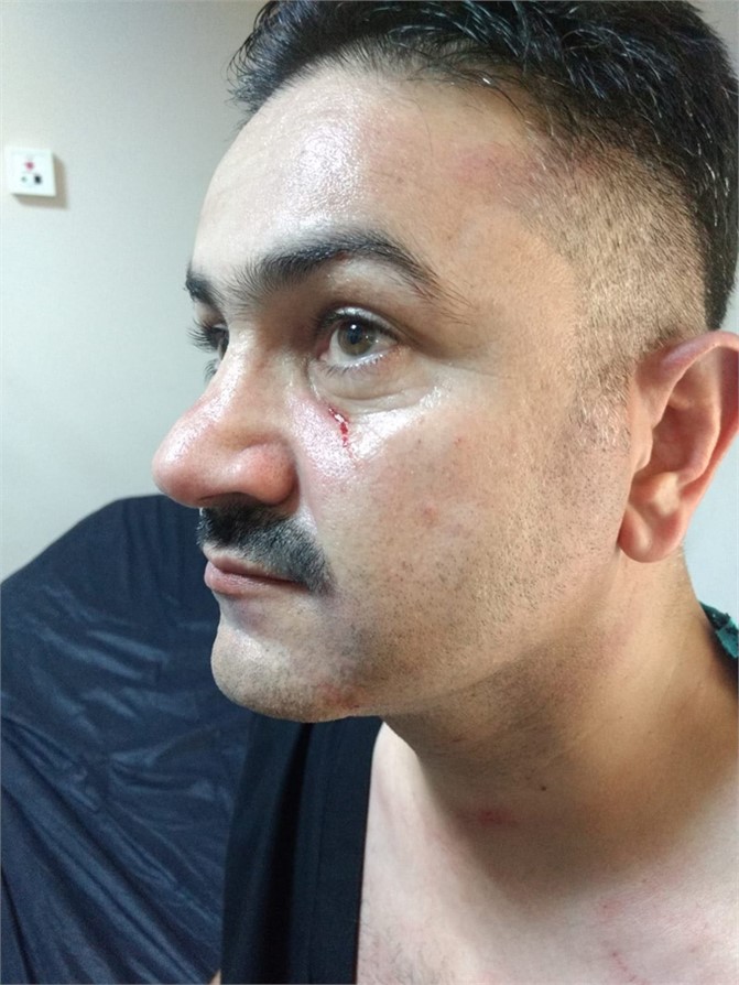 Mersin’de Sağlık Çalışanına Şiddet, Sendika Yöneticisinden Sağlık Personeline Şiddet