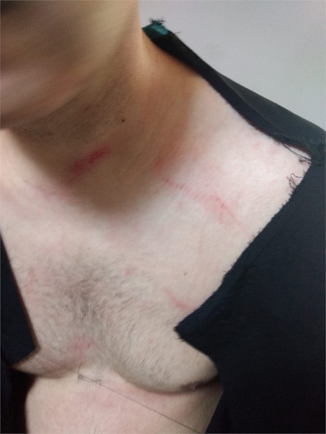 Mersin’de Sağlık Çalışanına Şiddet, Sendika Yöneticisinden Sağlık Personeline Şiddet