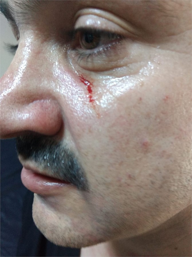 Mersin’de Sağlık Çalışanına Şiddet, Sendika Yöneticisinden Sağlık Personeline Şiddet