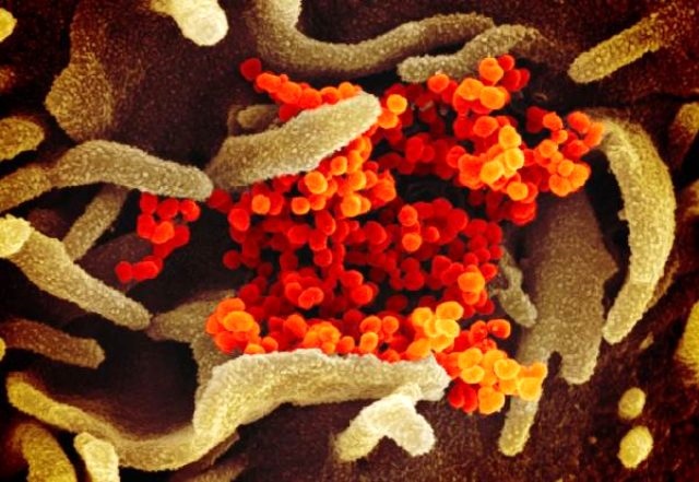 Koronavirüsün Fotoğrafları İlk Kez Yayımlandı