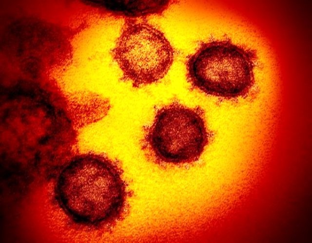 Koronavirüsün Fotoğrafları İlk Kez Yayımlandı