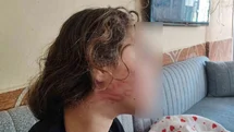 8 yaşındaki kızını darp eden çocuğun epilepsi hastası ablasını sokak ortasında dövdüğü iddiası