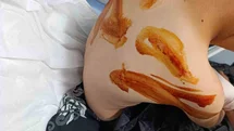 Şanlıurfa'da Çocuğa Sopa İle Dayak
