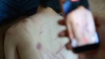 Down sendromlu oğlunun vücudundaki izleri görünce soluğu önce hastanede ardından adliyede aldı