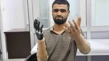 Muhammed'in Yeni Hayatı: Biyonik Kol ve Protez Bacak