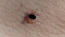 Doğu Karadeniz'de Kene Vakaları Düşük Seyrediyor