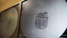 Samsun'da Ağrı Pili Umut Oluyor
