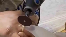 Van'da Kadının Yüzüğü Sıkıştı