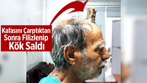 Başını Çarptıktan Sonra Filizlendi, 5 Yılda Bu Hale Geldi!