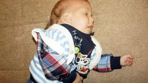 (özel Haber) 'ölecek' Denilen Bebeğe Yaşama Umudu Doğdu