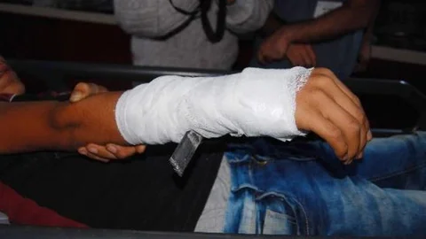 Oyun Oynarken Koluna Demir Çubuk Saplandı