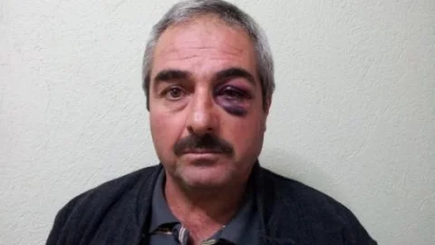 Karaman'da Öğretmene Kerpetenle Saldırı