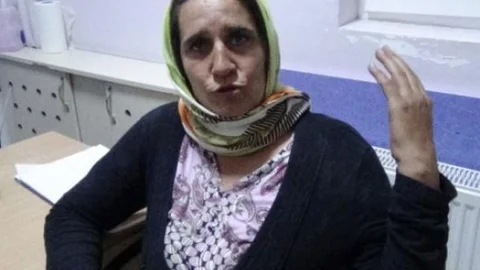 (özel Haber) Bir Annenin Bonzai İsyanı