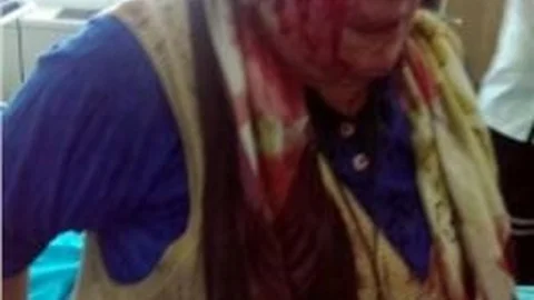 Kardeşi Tarafından Odunla Dövülen Kadın Hastanelik Oldu