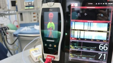 Türkiye'nin İlk “Non-Invaziv Hemodinamik Monitorizasyon” Cihazı Beü'de Hastanesi'nde
