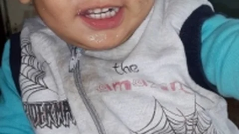 Minik Hüseyin Soğuk Algınlığı Şikayetiyle Götürüldüğü Hastanede Öldü