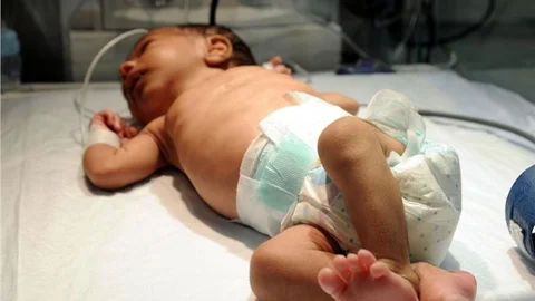 ''Bebeğinizi kalça çıkığına karşı muayene ettirin''