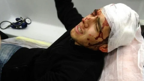 Hırsızlık Yaptı Dayak Yedi Son İşinde Tutuklandı