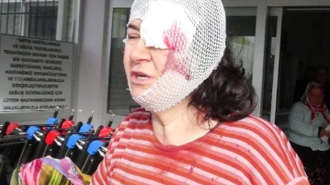 Eşi Ve Öğretmen Kaynı Tarafından Dövüldü