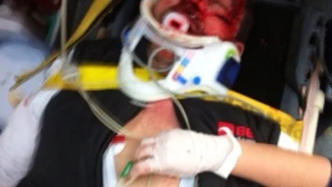 Sakarya'da Trafik Kazası 1 Yaralı