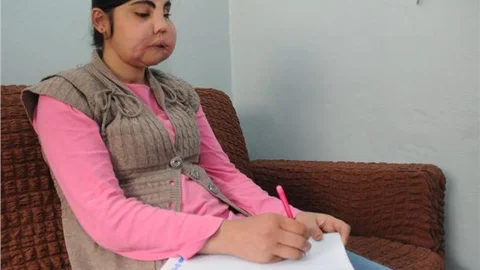 Yüz naklinin hikayesini kitaplaştırmak istiyor