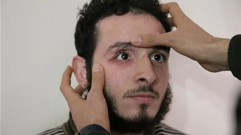 Savaşın izini yüzlerinden sildirmek istiyorlar