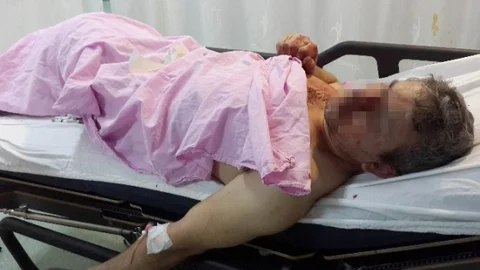 Samsun'da Bıçaklı Kavga 2 Yaralı