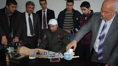 Yapay Kol ‘Feda' Basında SES Getirdi