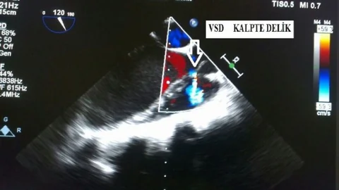Saü'de Başarılı Bir Ameliyata Daha İmza Atıldı