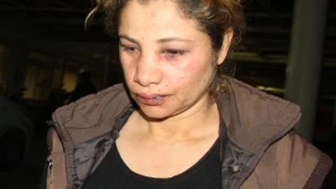 Kumasıyla Tartışan Kadın Kocası Tarafından Darp Edildi