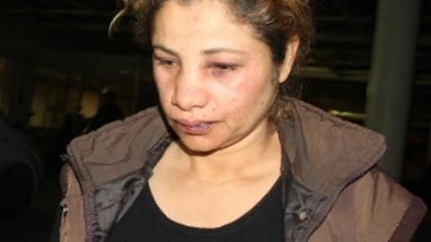 Dayakçı Koca ''Eşimi Ayıltmak İçin Tokatladım''