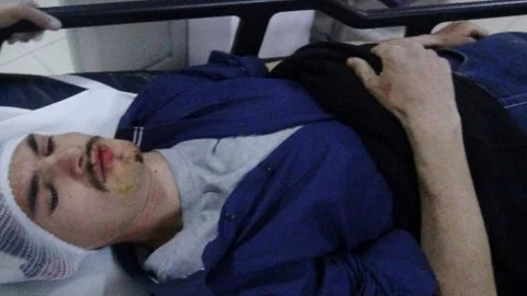 Akrabaların Tarla Kavgası Kanlı Bitti 7 Yaralı