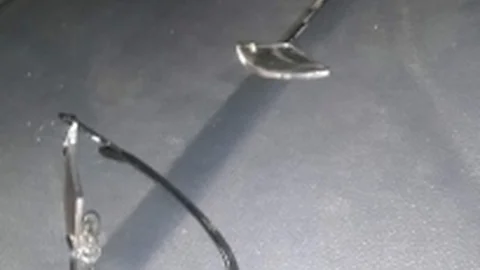 Öfkeli Kocanın Attığı Yumruk Polisin Gözlüğünü Kırdı