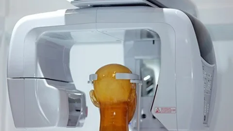 Diş Tedavisinde Teknolojik Gelişmeler