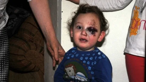 Bursa'da Dördüncü Kattan Düşen Çocuk Kurtuldu