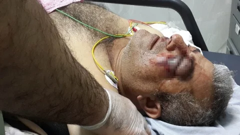 Samsun'da Ciğerci Kavgası