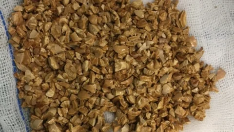 Karabük'te Mesaneden Taş Çıktı