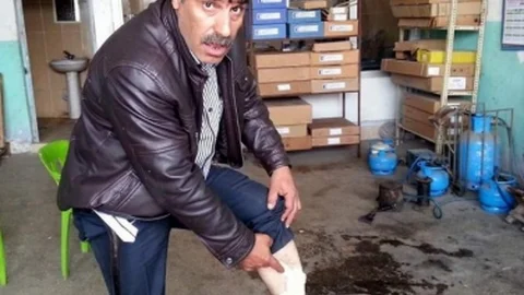Şanlıurfa'da Köpek Saldırısı Yaşandı