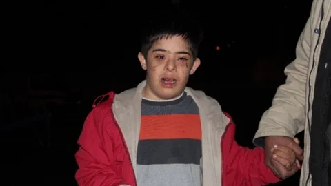 Adana'da Down Sendromlu Çocuk Darp Edildi