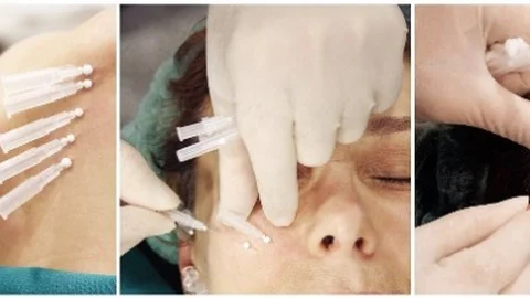 Örümcek Ağı Estetiği Üzerine Önemli Açıklamalar