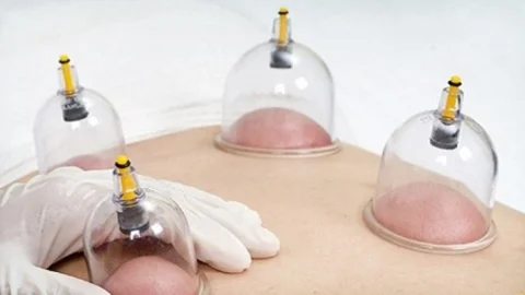 Hacamat Yöntemi ile Mevsim Değişikliğine Uyum Sağlayın