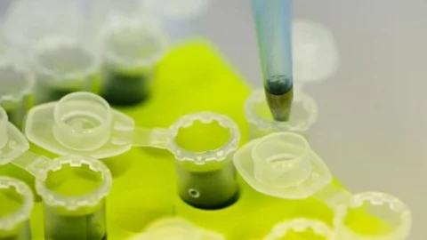 Sepsis Her 3 Saniyede 1 Can Alıyor