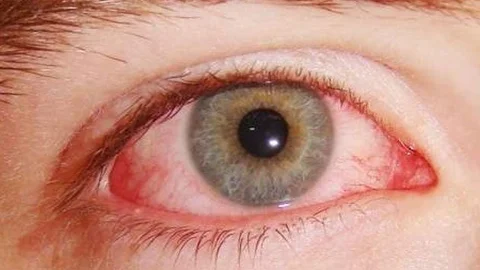 Konya'da Alerji Uyarısı