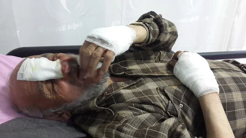 Samsun'da Motosiklet Kazası