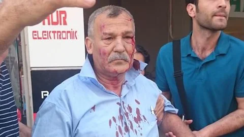 Adana'da Bombalı Saldırı Sonrası Yaşananlar