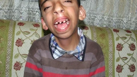 Muhammet'in Ameliyatı İçin Yardım Çağrısı