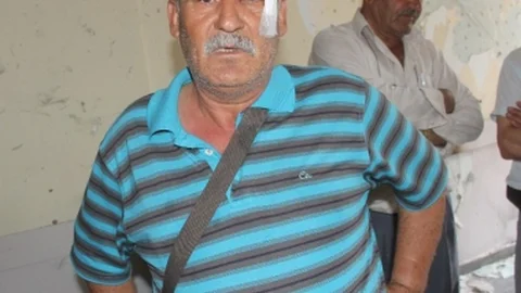 Adana'da Bombalı Saldırıdan Yaralı Kurtulan Eski Başkan Anlattı