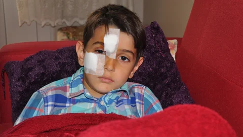 İznik'te Köpek Saldırısı