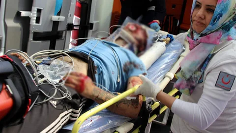 Kayseri'de Av Tüfeği İle Vuruldu